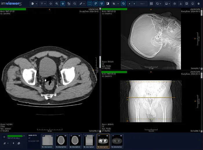 Visor DICOM web imViewer5