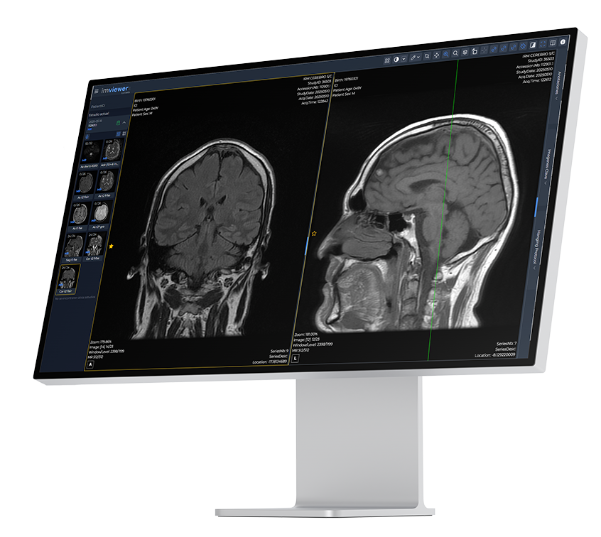 ImViewer4 Screenshot